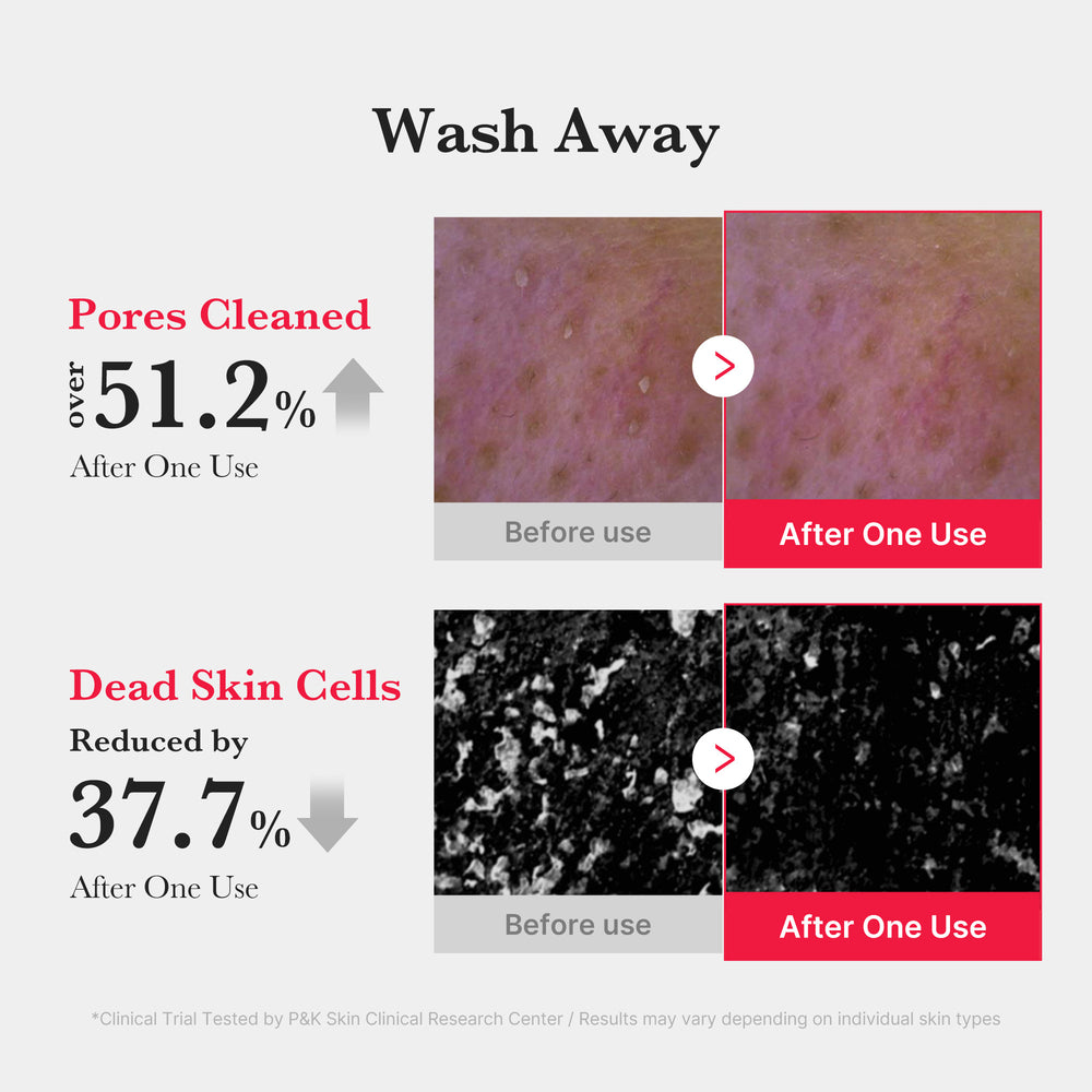 Salicylic Acid Foaming Facial Cleanser