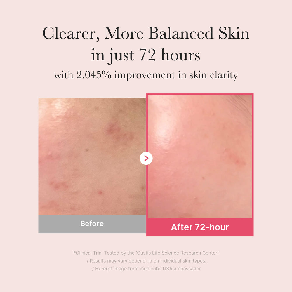 Tranexamic Acid Niacinamide Facial Serum