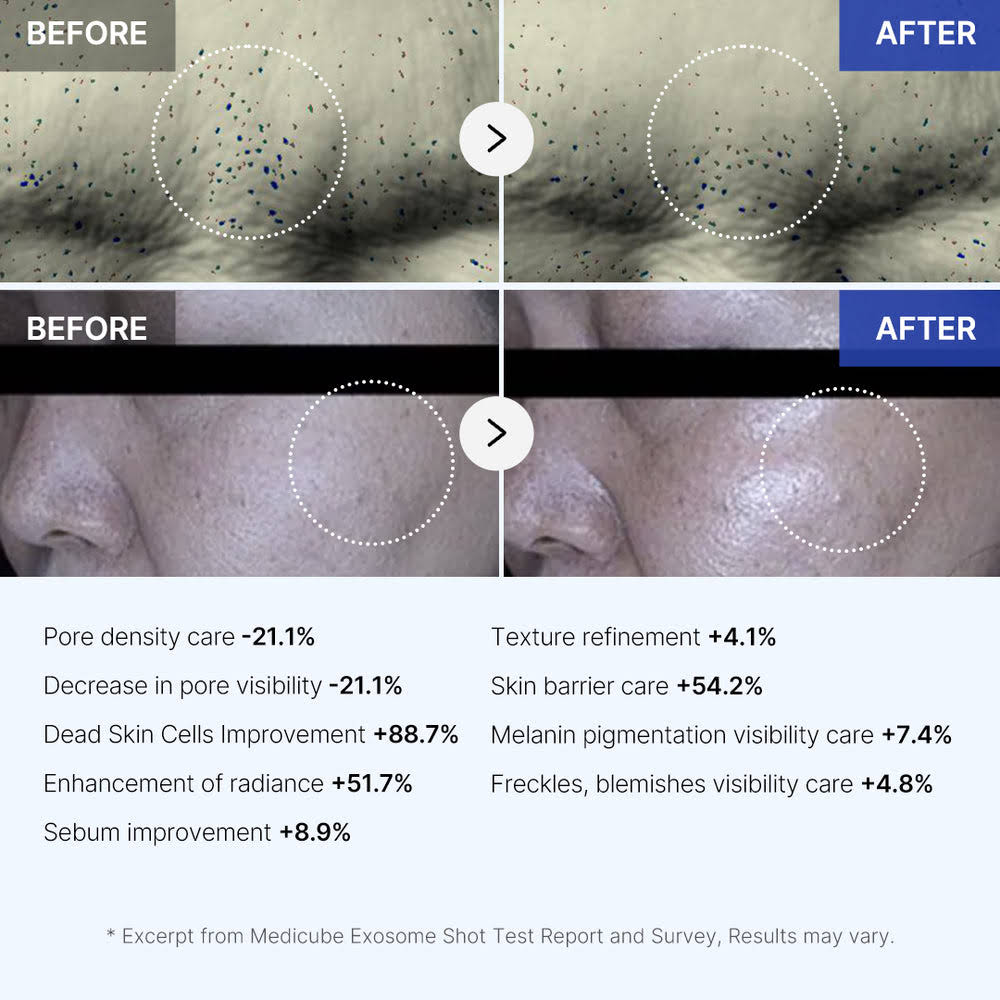 Micro-Spicule Facial Treatment Ampoule