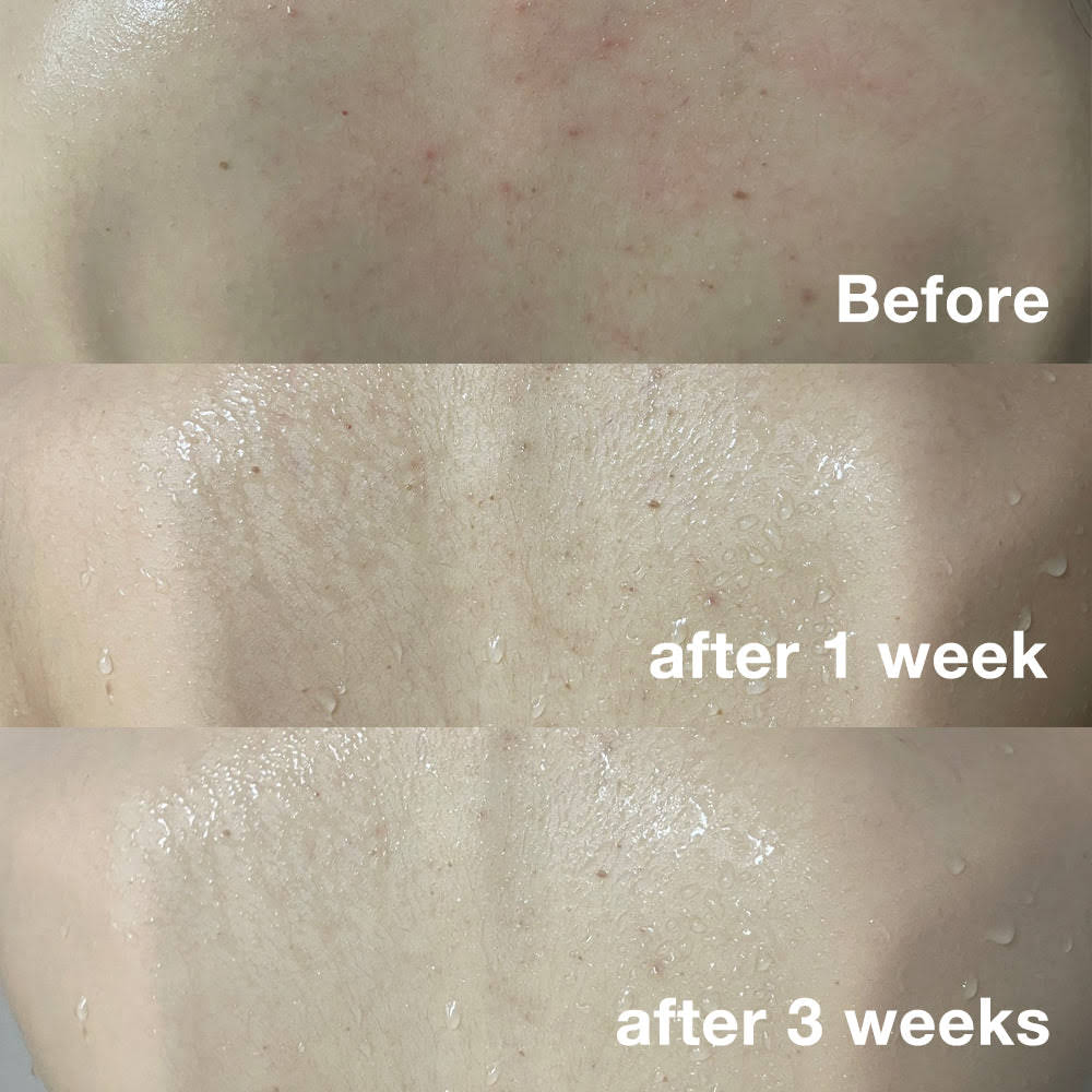 Face And Body Skin Care Set