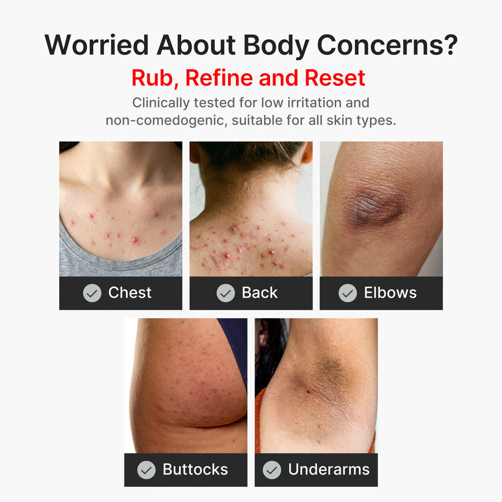 Kojic Acid Turmeric Body Exfoliating Serum